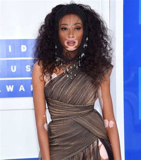 Winnie Harlow Net Worth 2024: From Runway to Riches